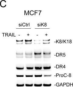 Fig.2.C showing Western Blotting from the publication: Cytokeratin 8/18 protects breast cancer cell lines from TRAIL-induced apoptosis.