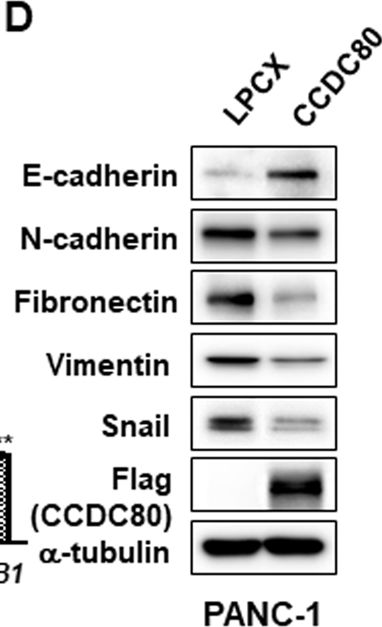 Fig.5.D showing Western Blotting in a Homo sapiens (Human) sample from the publication: Inhibition of TGF-β signalling in combination with nal-IRI plus 5-Fluorouracil/Leucovorin suppresses invasion and prolongs survival in pancreatic tumour mouse models.