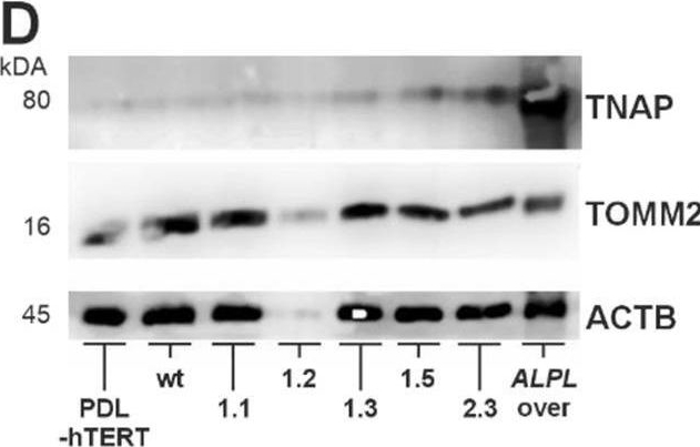 Fig.4.D showing Western Blotting in a Mus musculus (House mouse) sample from the publication: Establishment of human periodontal ligament cell lines with ALPL mutations to mimic dental aspects of hypophosphatasia.