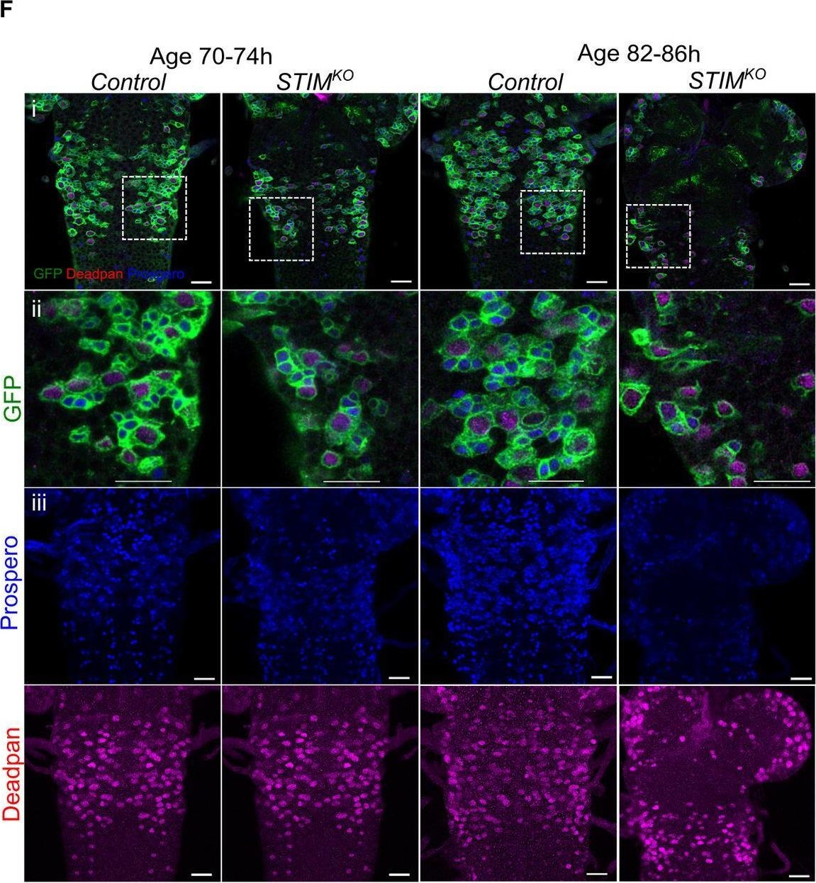 Fig.1.F showing Immunocytochemistry-immunofluorescence in a Drosophila melanogaster (Fruit fly) sample from the publication: A STIM dependent dopamine-neuropeptide axis maintains the larval drive to feed and grow in Drosophila.