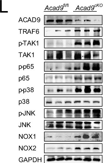 Fig.6.L showing Western Blotting from the publication: Moonlighting cytosolic function of ACAD9: suppression of TRAF6-mediated osteoclastogenesis and protection against osteoporosis.
