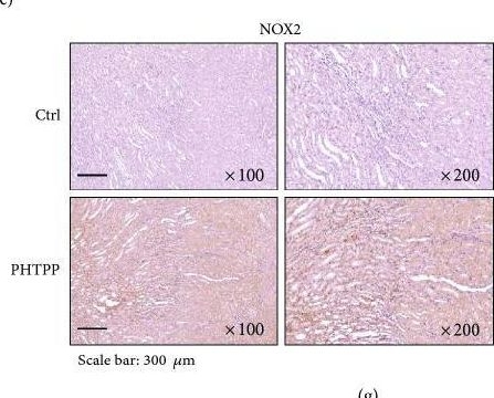 Fig.6.E showing Immunohistochemistry in a Homo sapiens (Human) sample from the publication: The Protective Roles of Estrogen Receptor β in Renal Calcium Oxalate Crystal Formation via Reducing the Liver Oxalate Biosynthesis and Renal Oxidative Stress-Mediated Cell Injury.