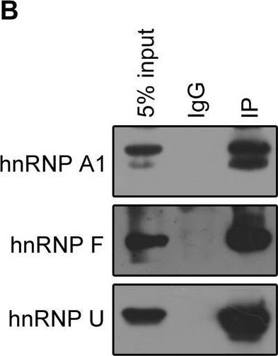 Fig.4.B showing Western Blotting in a Homo sapiens (Human) sample from the publication: MALAT1 modulates alternative splicing by cooperating with the splicing factors PTBP1 and PSF.