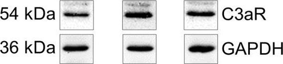 Complement Factor H-Related 3 Enhanced Inflammation and Complement Activation in Human RPE Cells.