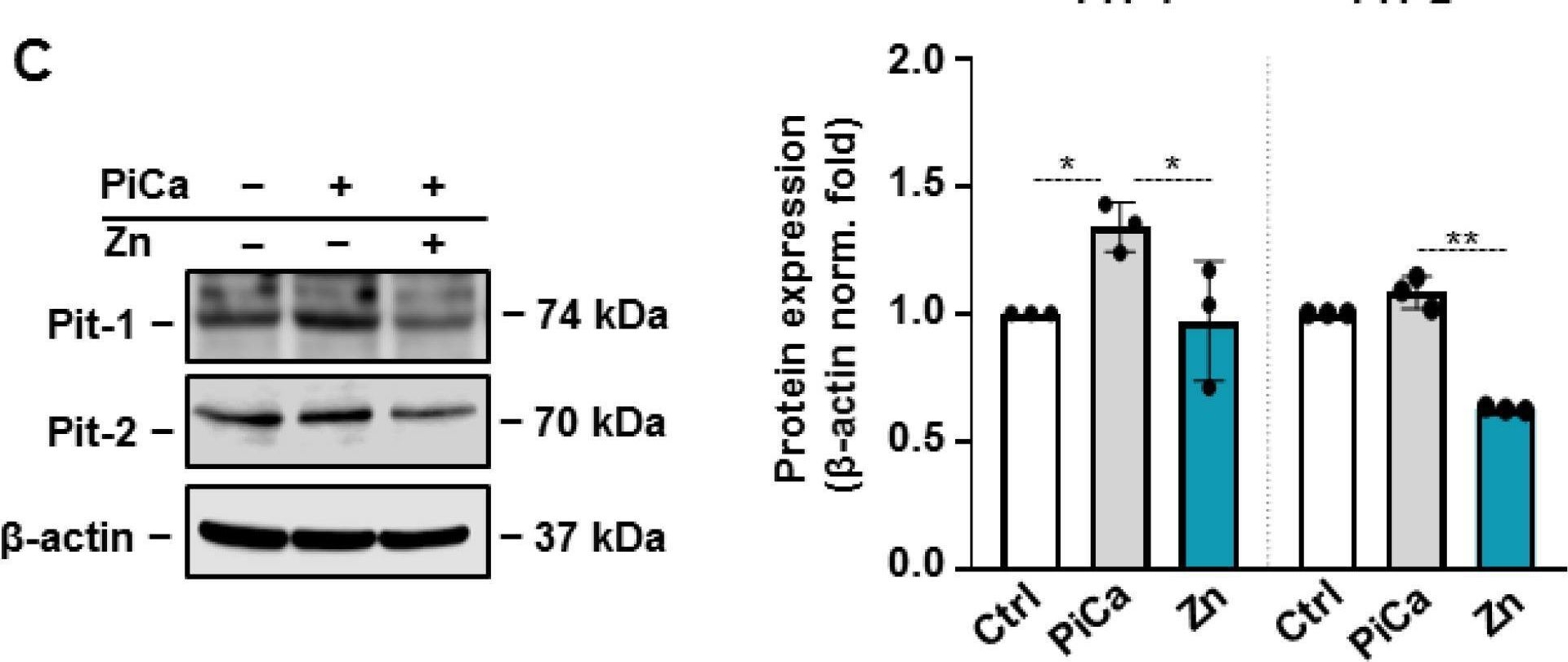 Fig.6.C showing Western Blotting in a Homo sapiens (Human) sample from the publication: Zinc Ameliorates High Pi and Ca-Mediated Osteogenic Differentiation of Mesenchymal Stem Cells.