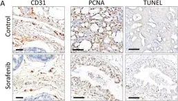 Fig.3.A showing Immunohistochemistry from the publication: Evaluation of in vivo responses of sorafenib therapy in a preclinical mouse model of PTEN-deficient of prostate cancer.