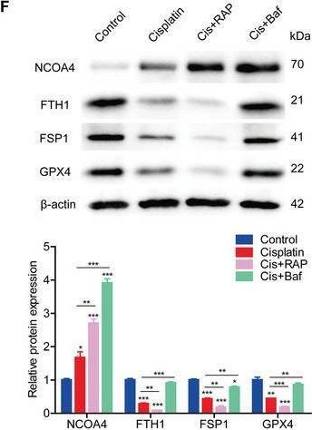 Fig.4.F showing Western Blotting from the publication: FOXO1-NCOA4 Axis Contributes to Cisplatin-Induced Cochlea Spiral Ganglion Neuron Ferroptosis via Ferritinophagy.