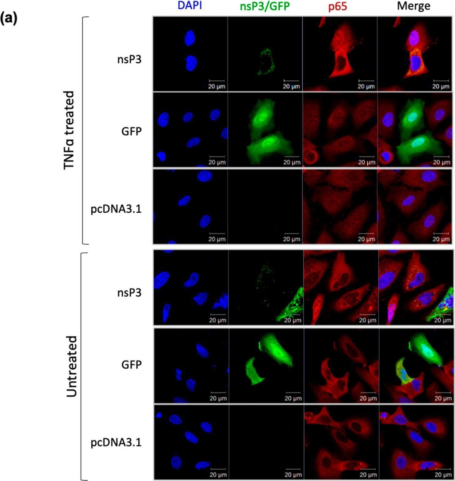 Fig.5.A showing Immunocytochemistry-immunofluorescence in a Homo sapiens (Human) sample from the publication: The Chikungunya Virus nsP3 Macro Domain Inhibits Activation of the NF-κB Pathway.