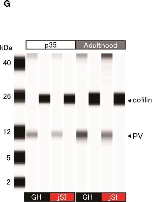 Fig.2.G showing Simple Western - Size in a Mus musculus (House mouse) sample from the publication: NARP-related alterations in the excitatory and inhibitory circuitry of socially isolated mice: developmental insights and implications for autism spectrum disorder.