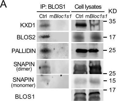 Fig.7.A showing Western Blotting in a Mus musculus (House mouse) sample from the publication: Brucella activates the host RIDD pathway to subvert BLOS1-directed immune defense.