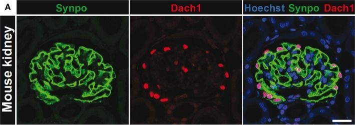 The transcription factor Dach1 is essential for podocyte function.