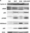 Fig.4.C showing Western Blotting in a Homo sapiens (Human) sample from the publication: MYC and RAS are unable to cooperate in overcoming cellular senescence and apoptosis in normal human fibroblasts.