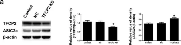 Fig.4.A showing Western Blotting from the publication: Glucose Deficiency Elevates Acid-Sensing Ion Channel 2a Expression and Increases Seizure Susceptibility in Temporal Lobe Epilepsy.