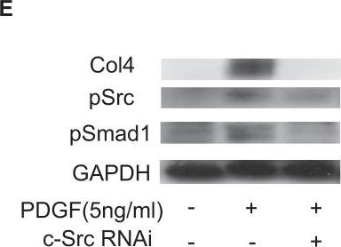Activation of Src mediates PDGF-induced Smad1 phosphorylation and contributes to the progression of glomerulosclerosis in glomerulonephritis.
