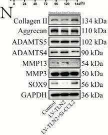 Fig.4.N showing Western Blotting in a Homo sapiens (Human) sample from the publication: Mechanical Load-Induced Upregulation of Talin2 through Non-Canonical Deubiquitination of OTUB1 Drives Facet Joint Osteoarthritis Pathogenesis.
