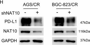 Fig.5.H showing Western Blotting from the publication: NAT10 promotes cisplatin resistance and immune escape by increasing the expression of DUSP1 and PD-L1 in gastric cancer.