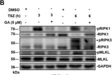 Phospho-RIP (Ser166) (D1L3S) Rabbit Monoclonal Antibody | Cell