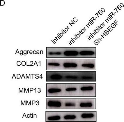 Fig.4.D showing Western Blotting in a Homo sapiens (Human) sample from the publication: MiR-760 targets HBEGF to control cartilage extracellular matrix degradation in osteoarthritis.