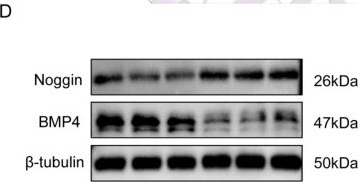 Fig.4.D showing Western Blotting from the publication: Hyperoxia promotes bronchopulmonary dysplasia via Noggin-mediated BMP4 antagonism and cellular senescence.
