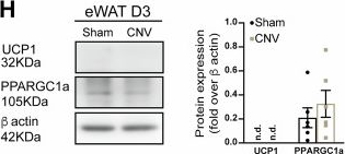 Fig.1.H showing Western Blotting in a Mus musculus (House mouse) sample from the publication: Adipocytes influence choroidal neovascularization via PRDM16.