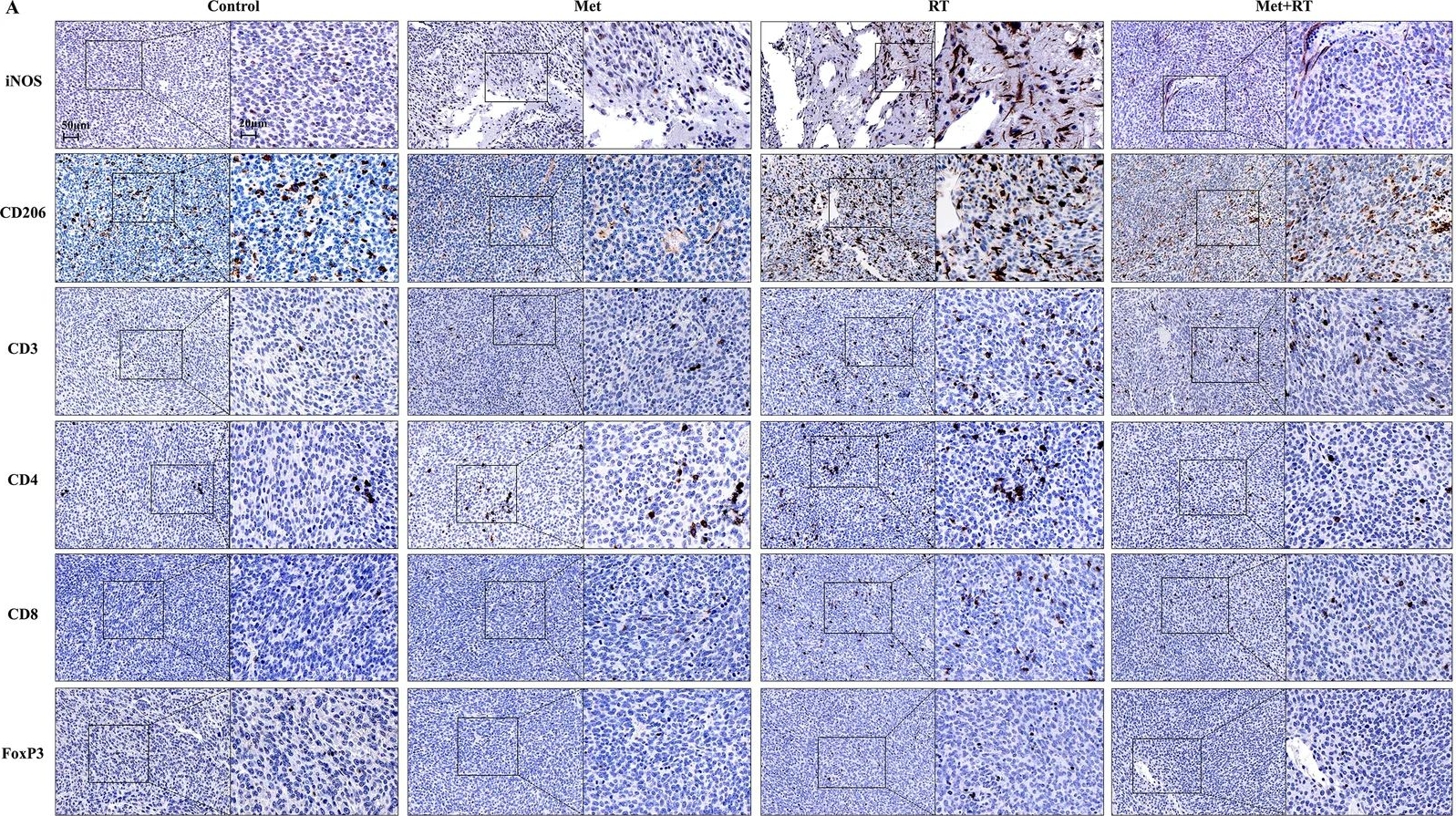 Fig.5.A showing Immunohistochemistry in a Mus musculus (House mouse) sample from the publication: Metformin modulates the phenotypes of tumor-associated macrophages in glioblastoma in a context-dependent manner by promoting the homeostasis of macrophages.
