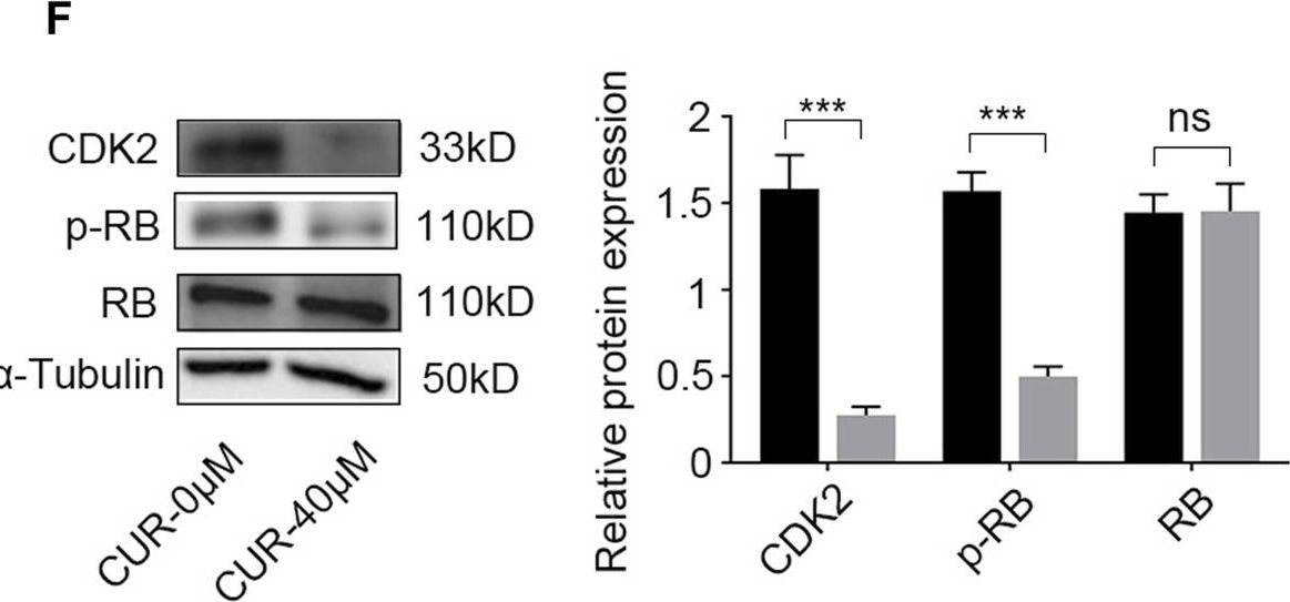 Fig.7.F showing Western Blotting in a Homo sapiens (Human) sample from the publication: Network pharmacology and molecular docking reveal the mechanisms of curcumin activity against esophageal squamous cell carcinoma.