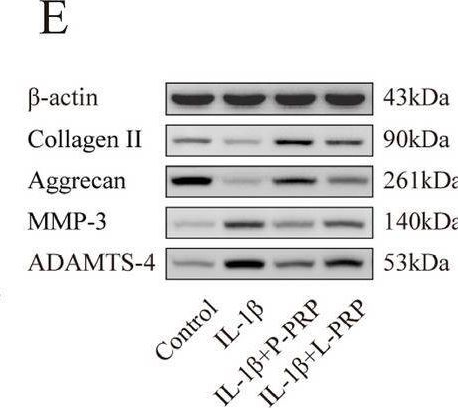 Fig.5.E showing Western Blotting from the publication: Pure platelet-rich plasma promotes semaphorin-3A expression: a novel insight to ameliorate intervertebral disk degeneration in vitro.