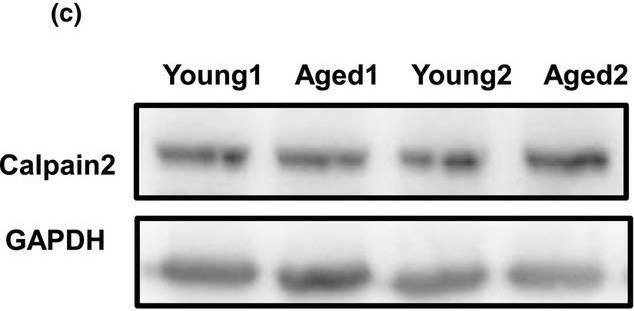 Fig.4.C showing Western Blotting in a Mus musculus (House mouse) sample from the publication: CaMKIIα-TARPγ8 signaling mediates hippocampal synaptic impairment in aging.