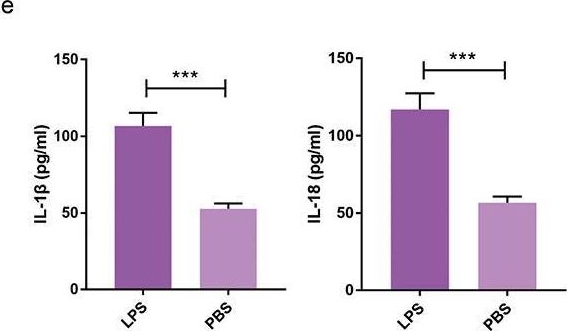 Fig.1.E showing Enzyme-linked immunosorbent assay from the publication: Knocking down ETS Proto-oncogene 1 (ETS1) alleviates the pyroptosis of renal tubular epithelial cells in patients with acute kidney injury by regulating the NLR family pyrin domain containing 3 (NLRP3) transcription.