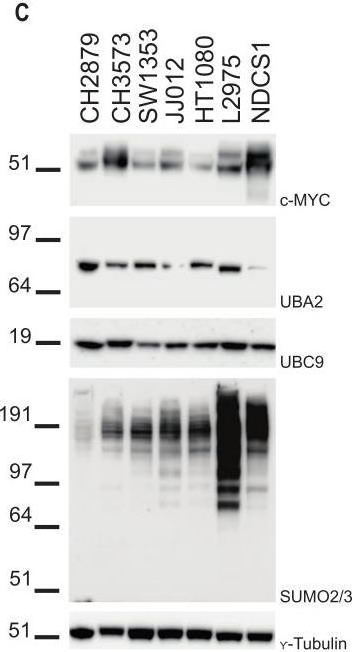 Fig.3.C showing Western Blotting from the publication: SUMOylation Is Associated with Aggressive Behavior in Chondrosarcoma of Bone.