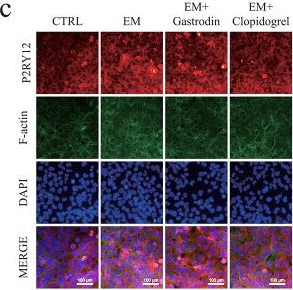 Fig.7.C showing Immunocytochemistry-immunofluorescence from the publication: Gastrodin alleviates neuronal damage in epileptic cell models by targeting P2RY12 to inhibit microglial hyperactivation.
