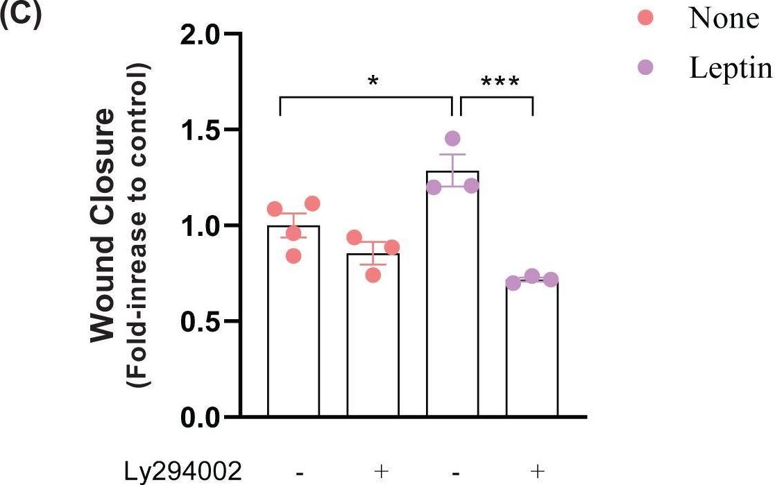 Fig.4.C from the publication: Targeting the leptin receptor promotes MDA-MB-231 cells' metabolic reprogramming and malignancy: the role of extracellular vesicles derived from obese adipose tissue.
