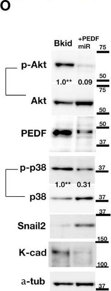 Fig.4.O showing Western Blotting in a Homo sapiens (Human) sample from the publication: Pigment Epithelium Derived Factor Is Involved in the Late Phase of Osteosarcoma Metastasis by Increasing Extravasation and Cell-Cell Adhesion.
