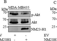 Fig.3.B showing Western Blotting in a Homo sapiens (Human) sample from the publication: The metastasis suppressor protein NM23-H1 modulates the PI3K-AKT axis through interaction with the p110α catalytic subunit.