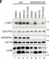 Fig.7.F showing Western Blotting from the publication: GRASP55 maintains lysosome function by controlling sorting of lysosomal enzymes at the Golgi.