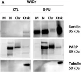 Fig.3.A showing Western Blotting from the publication: Overexpression of sortilin is associated with 5-FU resistance and poor prognosis in colorectal cancer.