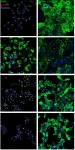Fig.7.A showing Immunocytochemistry-immunofluorescence in a Homo sapiens (Human) sample from the publication: Metabolism of phosphatidylinositol 4-kinase IIIα-dependent PI4P Is subverted by HCV and is targeted by a 4-anilino quinazoline with antiviral activity.