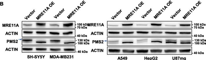 Fig.6.B showing Western Blotting from the publication: MRE11A: a novel negative regulator of human DNA mismatch repair.