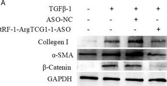 Fig.5.A showing Western Blotting in an Acipenser baerii (Siberian sturgeon) sample from the publication: tRF-1-ArgTCG-1-1 promotes renal fibrosis by regulating β-catenin.