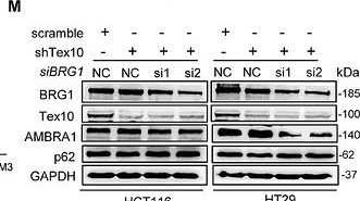 Fig.4.M showing Western Blotting from the publication: Targeting Tex10 Overcomes Oxaliplatin Resistance by Competitively Disrupting the Non-Canonical BAF Complex in Colorectal Cancer.
