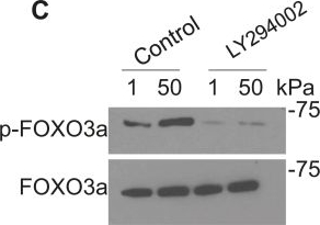 Fig.5.C showing Western Blotting from the publication: ECM stiffness regulates lung fibroblast survival through RasGRF1-dependent signaling.