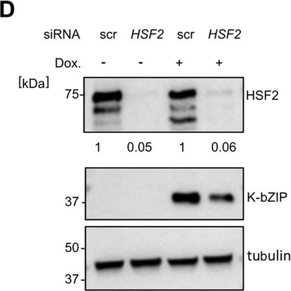 Fig.2.D showing Western Blotting in a Homo sapiens (Human) sample from the publication: Heat shock factor 2 regulates oncogenic gamma-herpesvirus gene expression by remodeling the chromatin at the ORF50 and BZLF1 promoter.