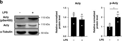 Fig.1.B showing Western Blotting in a Mus musculus (House mouse) sample from the publication: Macrophage ATP citrate lyase deficiency stabilizes atherosclerotic plaques.
