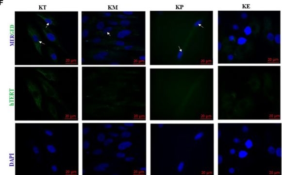 Fig.1.F showing Immunocytochemistry-immunofluorescence from the publication: Development and validation of novel keloid-derived immortalized fibroblast cell lines.