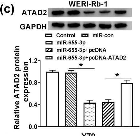 Fig.6.C showing Western Blotting in a Homo sapiens (Human) sample from the publication: lncRNA MALAT1 regulated ATAD2 to facilitate retinoblastoma progression via miR-655-3p.