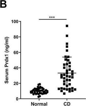 Fig.1.B showing Enzyme-linked immunosorbent assay in a Mus musculus (House mouse) sample from the publication: Peroxiredoxin 1 promotes intestinal inflammation by activating the NLRP3 inflammasome in macrophages through lysosomal disruption in Crohn's disease.