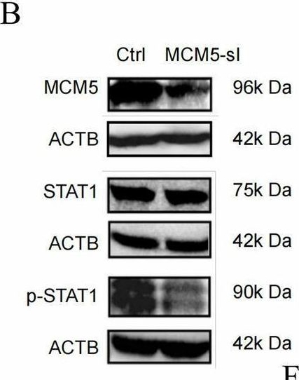 Fig.7.B showing Western Blotting in a Danio rerio (Zebrafish) sample from the publication: Mcm5 mutation leads to silencing of Stat1-bcl2 which accelerating apoptosis of immature T lymphocytes with DNA damage.