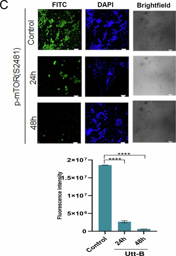 Fig.2.C showing Immunocytochemistry-immunofluorescence in a Homo sapiens (Human) sample from the publication: Uttroside B, a US FDA-designated 'Orphan Drug', mitigates the development of hepatocellular carcinoma and its pulmonary metastasis via EGFR/ERK-mediated inhibition of SREBP-1 and STAT-3.