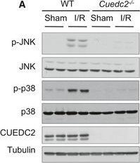 Fig.3.A showing Western Blotting in a Mus musculus (House mouse) sample from the publication: CUEDC2 modulates cardiomyocyte oxidative capacity by regulating GPX1 stability.