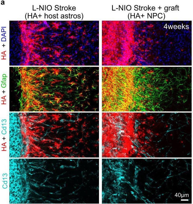 Fig.6.A from the publication: Lesion environments direct transplanted neural progenitors towards a wound repair astroglial phenotype in mice.